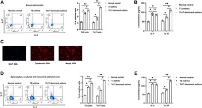 MBD2 mediates Th17 cell differentiation by regulating MINK1 in Th17-dominant asthma